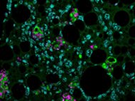 Hepatic Stellate Cells