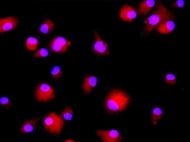 Human Bone Marrow-Derived Dendritic cells
