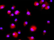 Human Bone Marrow-Derived Dendritic cells