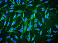 Human Bone Marrow-Derived Mesenchymal Stem Cells