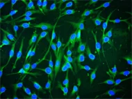 Human Bone Marrow-Derived Mesenchymal Stem Cells
