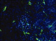 Human Bone Marrow-Derived Mononuclear cells