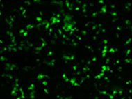 Human Bone Marrow-Derived NK Cells