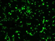 Human Bone Marrow-Derived NK Cells