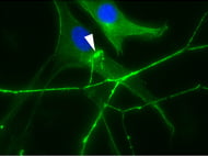 Dental Pulp Mesenchymal Stem Cells