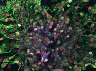 Human Peripheral Blood-Derived NK Cells