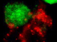Human Umbilical Cord Blood Derived NK cells