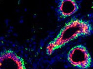 Human Mammary epithelial cells