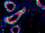 Human Mammary Fibroblasts