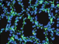 Human Mammary Smooth Muscle Cells