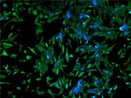 Human Ovarian Fibroblasts