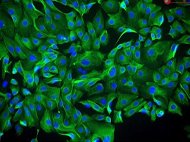Human Ovarian Surface Epithelial Cells