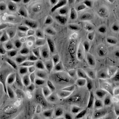 Human Ovarian Surface Epithelial Cells - Kosheeka