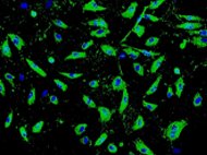Human Seminal Vesicles Endothelial cells