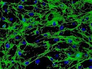 Human Seminal Vesicles Fibroblasts
