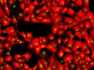 Human Seminal vesicles microvascular endothelial cells