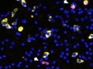 BalbC Cardiac fibroblasts