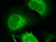 C57 Mouse Lung Cytosol
