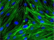 Human Aortic Endothelial Cells
