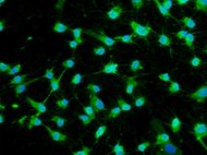 Human Skin Derived Dermal Fibroblasts Adult