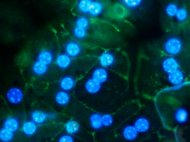 Rat Hepatocytes Suspension SD