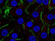 Human Hepatocytes in Suspension