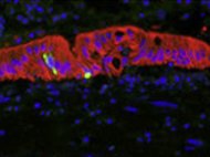 CD-1 Mouse Intestine Microsomes