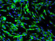 Human Kidney Fibroblasts