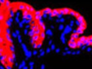 Human Eye Derived Limbal Fibroblasts