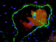 BalbC Brain vascular pericytes