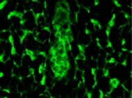Rat Lymphatic Fibroblasts SD