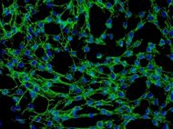 Rat Lymphatic Fibroblasts Wistar