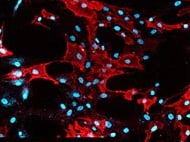 Mesenchymal Stem Cells