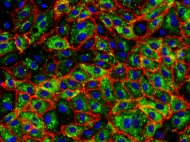 Human Microvascular Endothelial Cells