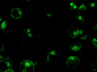 Rat Bone Marrow Derived Mononuclear Cells Immuno-deficient