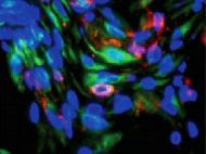 Rat Bone Marrow Derived NK Cells Immuno-deficient