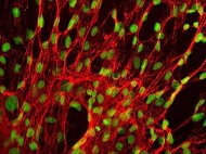 Human Splenic Fibroblasts