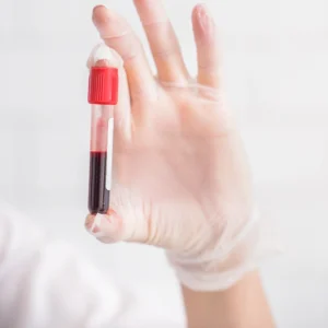 wo notable clinical breakthroughs, liquid biopsies, and CAR-T therapy, stand out as exemplary instances where the utilization of fresh blood products from healthy patients has been instrumental in pioneering transformative medical developments.