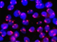 BALB/c Mouse Heart Cytosol
