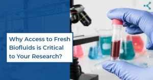 Read more about the article Why Access to Fresh Biofluids is Critical to Your Research?