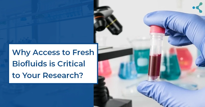 You are currently viewing Why Access to Fresh Biofluids is Critical to Your Research?