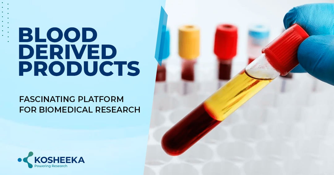 You are currently viewing Blood Derived Products: Fascinating Platform for Biomedical Research