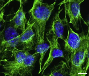 Kidney Fibroblasts