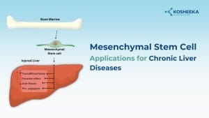 Read more about the article Exploring Mesenchymal Stem Cell Applications for Chronic Liver Diseases
