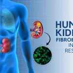 Human Kidney Fibroblasts in Renal Research
